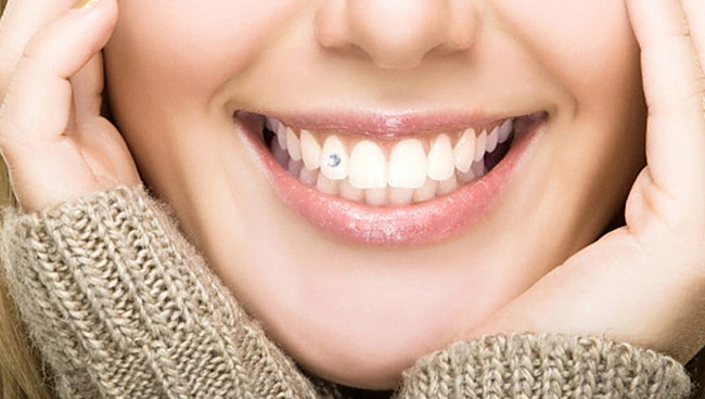 Estetska stomatologija | Dentist Montenegro